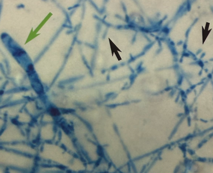 <p>“Picket-fence” </p>