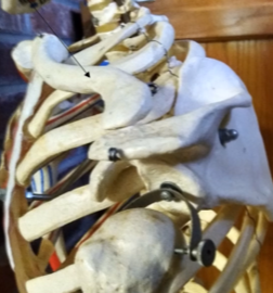 <p>What is this bone?</p>