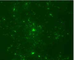 <p>preferred acid-fast stain</p><p>-sediments for mycobacteria</p>