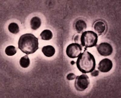 <p>prevalent in south america. causes a chronic granulomatous disease</p>