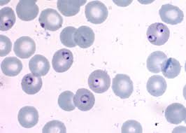 <p>Malaria</p>
