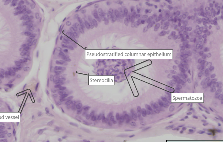 <p>head of epididymis</p><p>stereocilia get shorter moving down the epididymis</p>