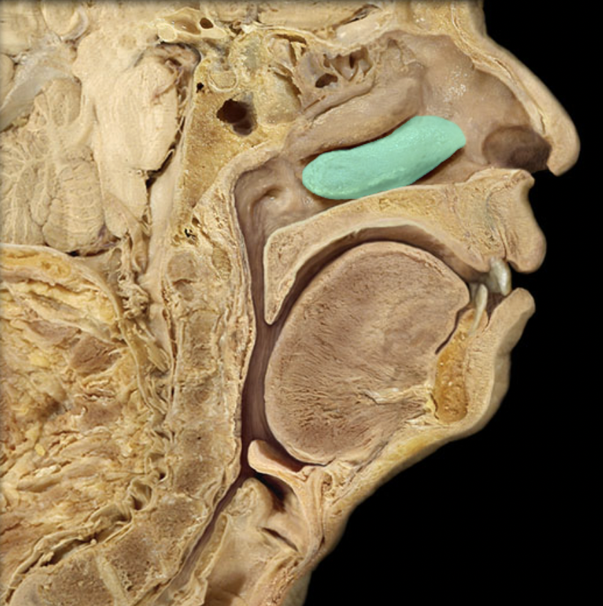 <p>Identify the feature of the nasal cavity</p>