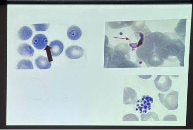 <p>What is this organism?</p>