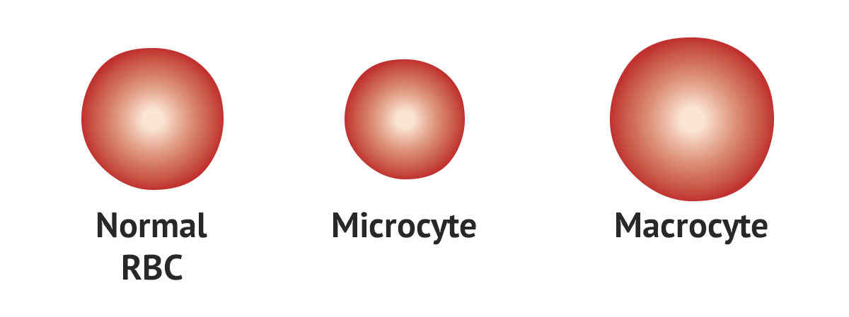 <p>What are microcytes?</p>