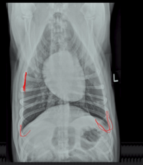 <p>What do those little "u's" represent at the lower right and left hand corners of the screen in this normal thorax?</p>