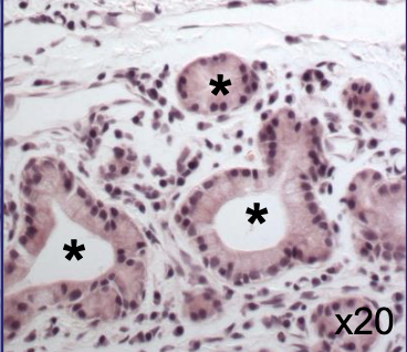 <p>Identify </p><ul><li><p>what is the asterisks </p></li></ul><p></p>