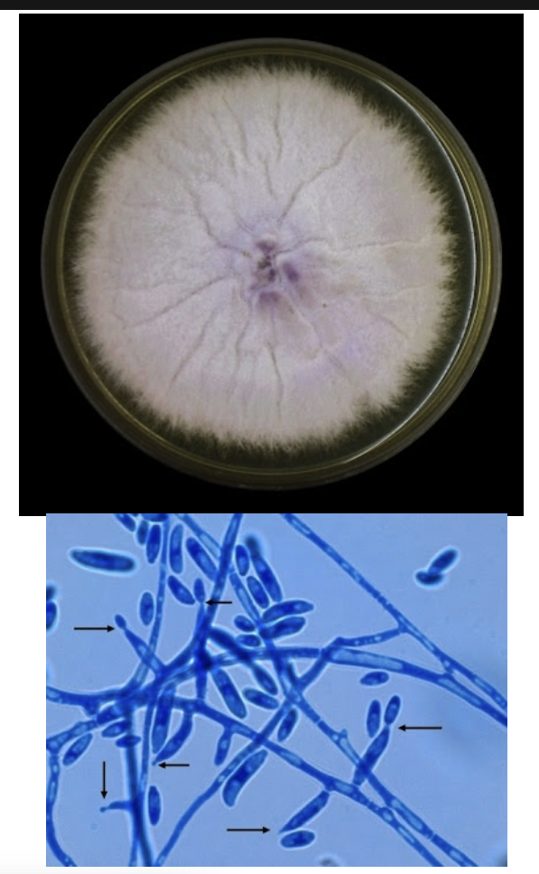 <p>-Violet colonies</p><p>-”Canoe” or “banana” microconidia</p>