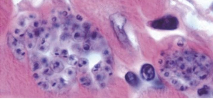 <p>from heart muscle of a dog that died of cardiac disease</p>