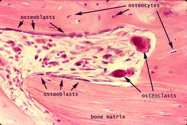 <p>derive from bone lining cells, form bone matrix</p>