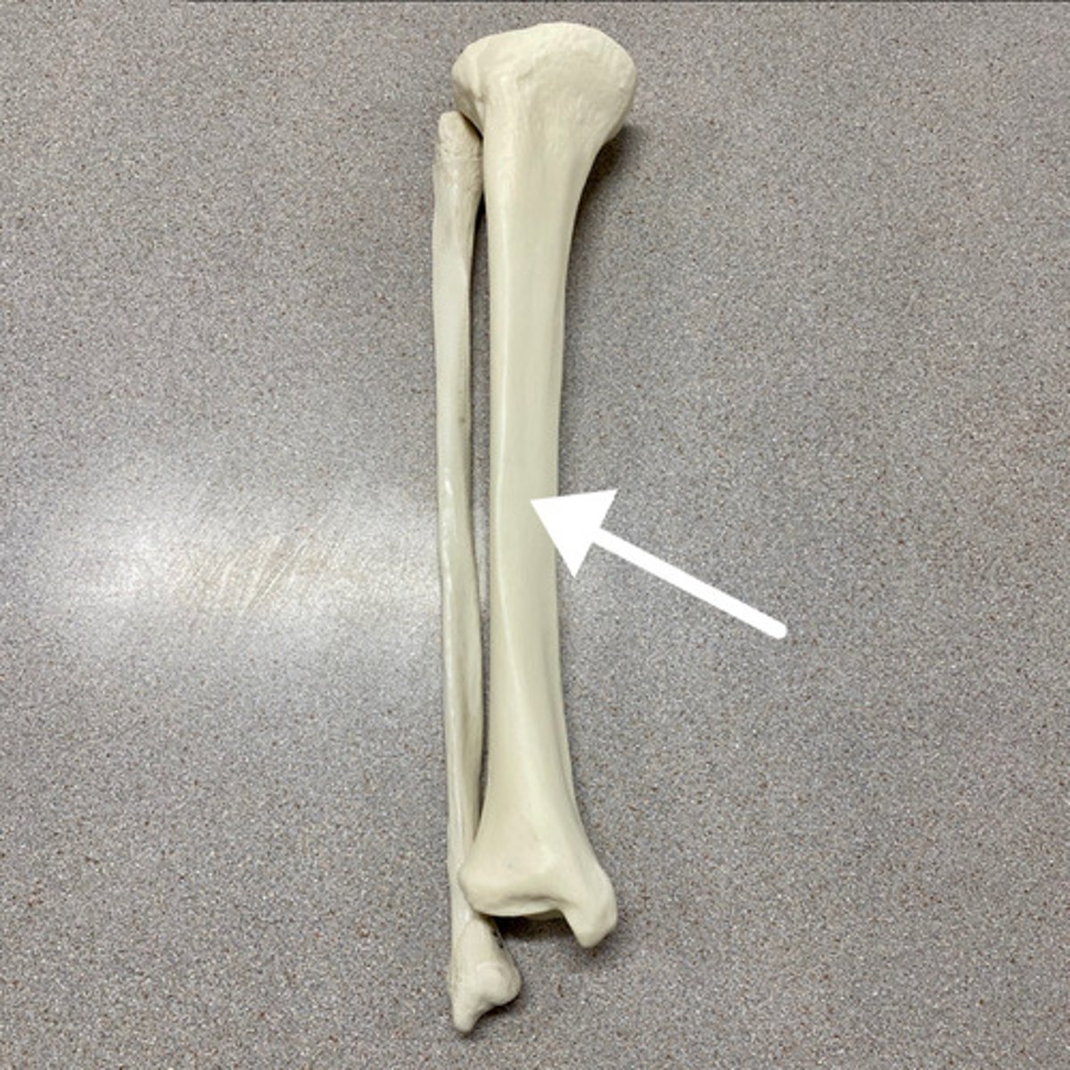 <p>What bone is this?</p>