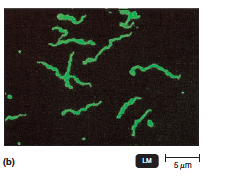 <p>Uses UV light</p><p>Fluorescent substances absorb UV light and emit visible light</p><p>Cells may be stained with fluorescent dyes (fluorochromes)</p>