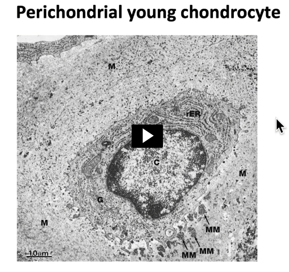 <p>you will see in this other image a chondrocyte. This chondrocyte as you can see is oval shaped, a prominent nucleus that is centric and spherical and contains a numerous amount of organelles and scaffolding needed for it to succeed in its function of synthesizing  the extracellular matrix. </p>