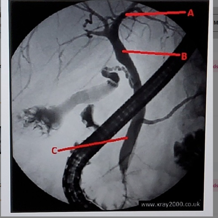 <p>what is letter C</p>