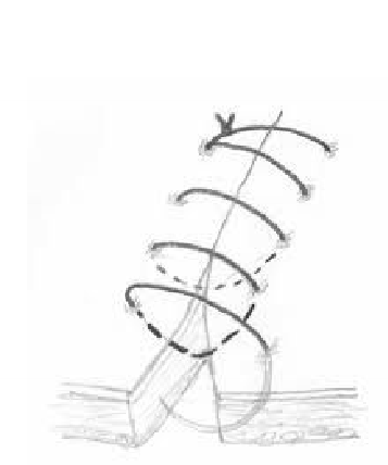<p>Simple continuous </p>