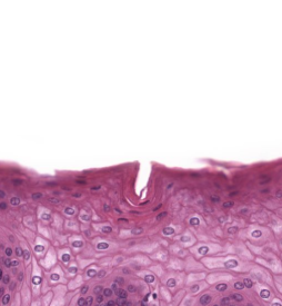 <p>What type of epithelial tissue is this?</p>