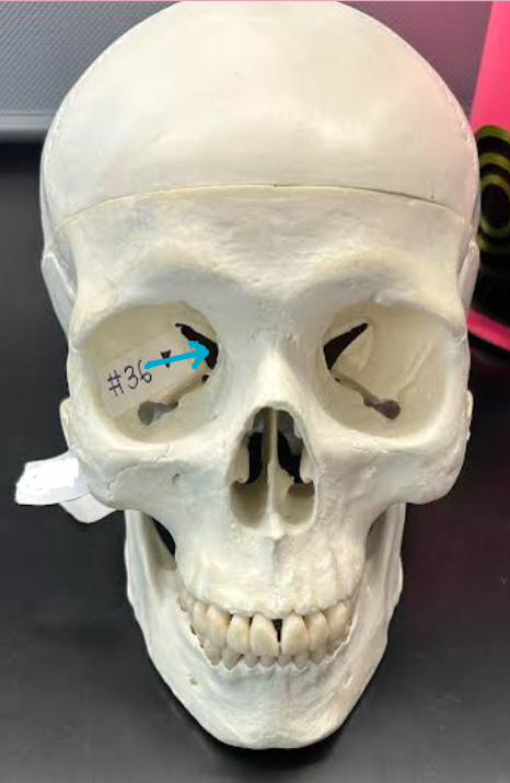 <p>ID skull hole region </p>
