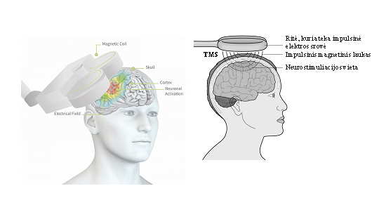 <p>tai metodas, kai <strong>kintamas magnetinis laukas veikia galvos smegenis per kaukolę</strong> → srovės <strong>sužadina arba slopina neuronų aktyvumą</strong></p>