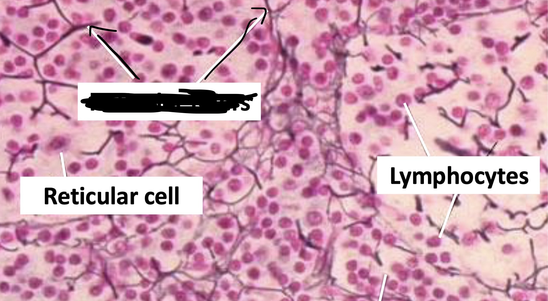 <p>What is the arrow pointing to? </p>