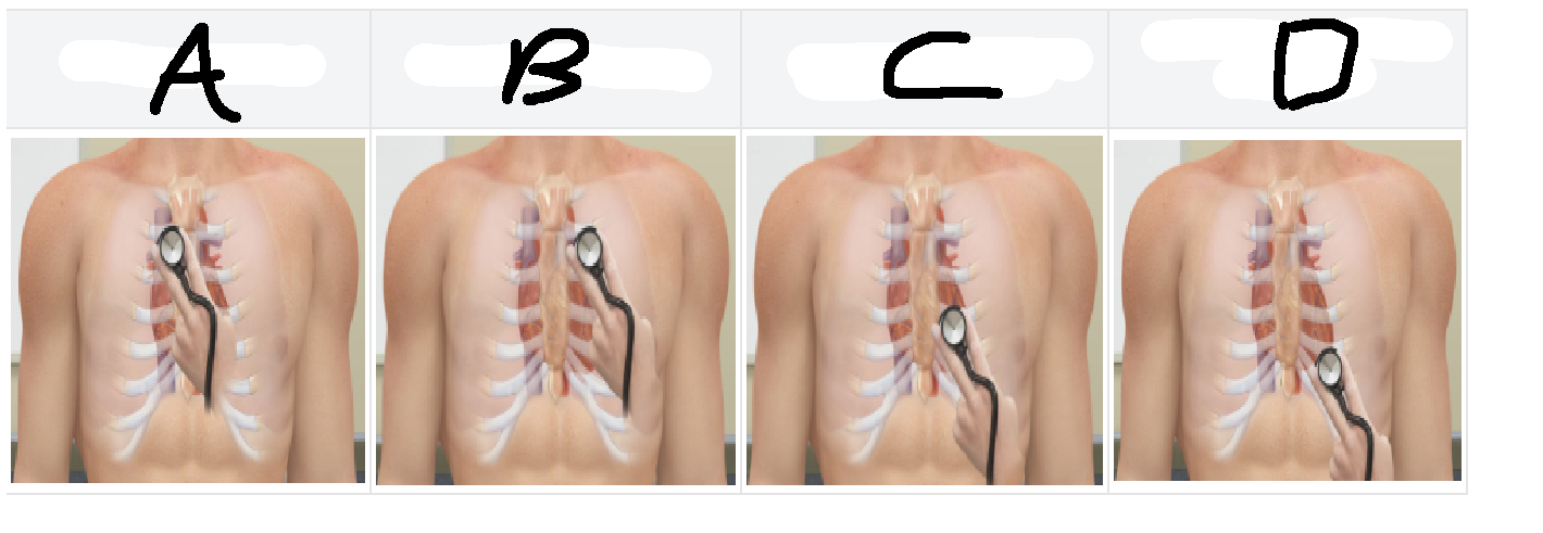<p>According to the diagram, what label marks the best location to hear the right AV, or tricuspid, valve?</p>