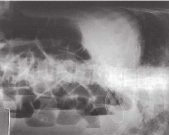 <p><strong>What is the patient position for this projection?</strong></p>
