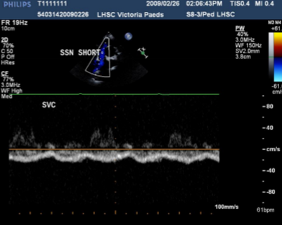 <p>Describe the findings of this image.</p>