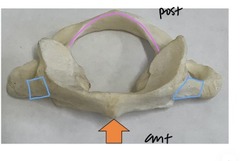 <p>whats outlined in pink?</p>