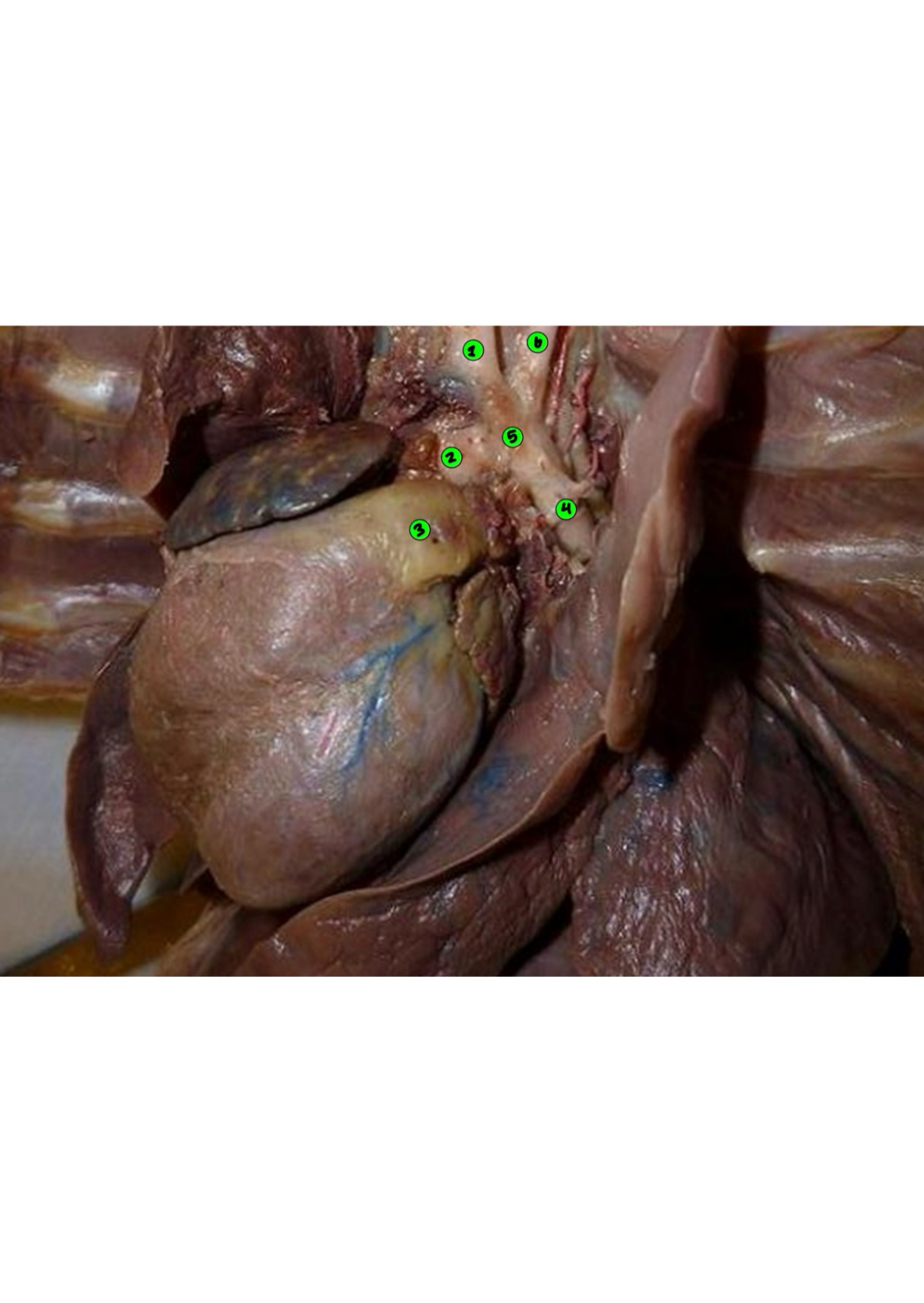 <p>Blood from structure 6 came from…</p>