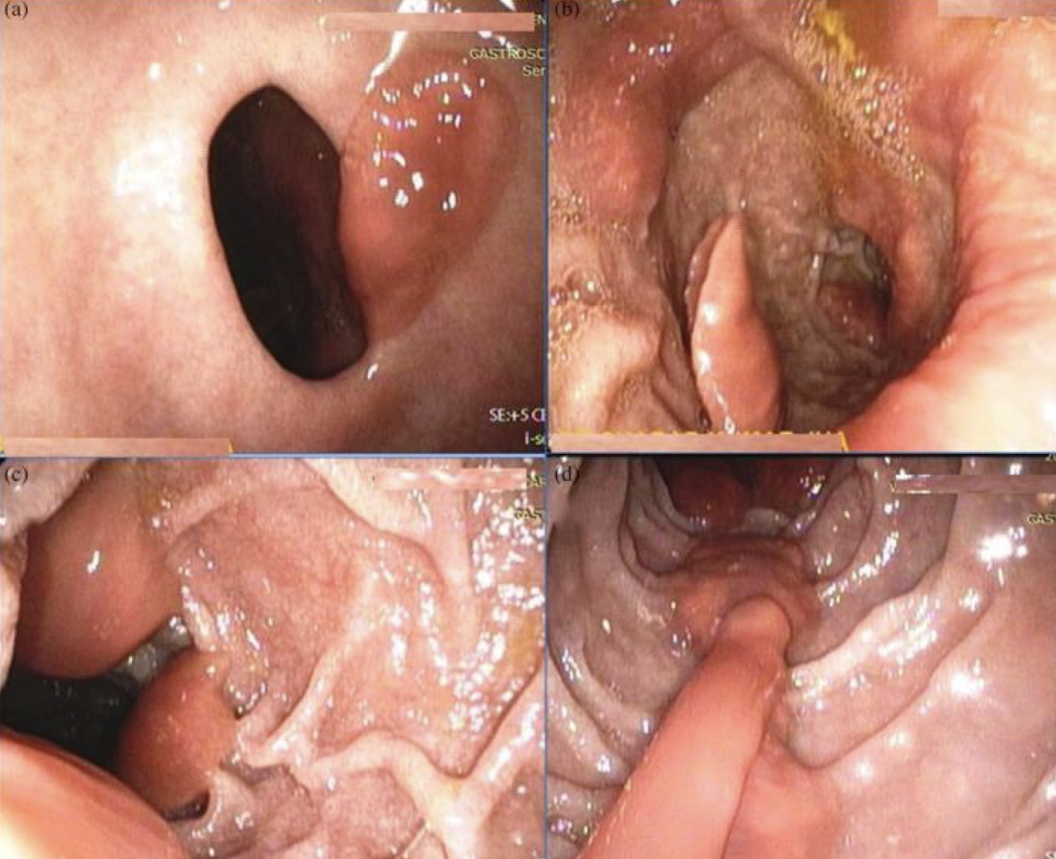<p>What parasite is/causes this?</p>