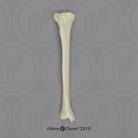 <p>T-shaped bone; larger of the two main distal leg bones</p>