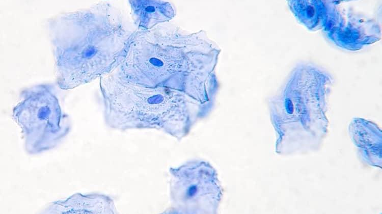 <p>What type of cell is this? What part is the nucleus?</p>