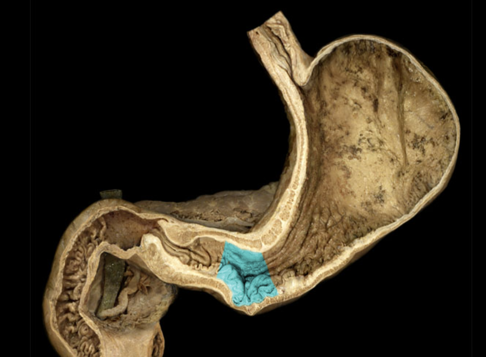 term image