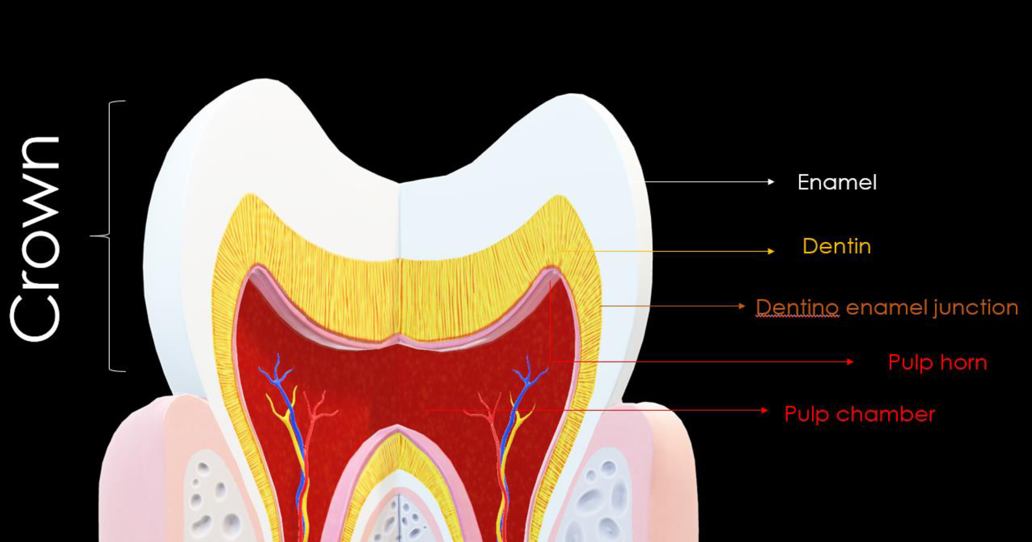 <ol><li><p>Enamel</p></li><li><p>Dentin </p></li><li><p>Dentino Enamel Junction</p></li><li><p>Pulp horn</p></li><li><p>Pulp Chamber</p></li></ol><p></p>