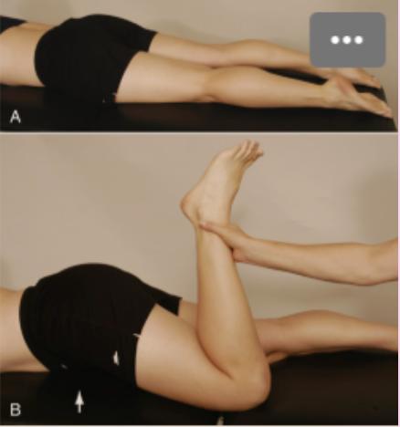 <p><strong>Ely's Test</strong></p><ul><li><p><strong>How:</strong> Patient prone. Passively <strong>flex the knee</strong> while observing the hip.</p></li><li><p><strong>Positive:</strong> <strong>Passive knee flexion causes spontaneous ipsilateral hip flexion</strong>, indicating a <strong>tight rectus femoris</strong>.</p></li></ul><p><strong>Another test / Clinical presentation:</strong></p><ul><li><p><strong>Resisted Knee Extension (RROM)</strong> – <strong>pain with resisted knee extension</strong> suggests <strong>rectus femoris involvement</strong>.</p></li></ul><p></p>