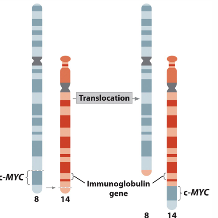 <p>Abnormal function of B cells </p><p>Reciprocal translocation between chromosomes 8 and 14 places c myc (oncogene that promotes cell division) next to an enhancer which normally stimulates production of antibodies.</p><p> Cell division is stimulated in B cells. </p><p>Same genes are present, but chromosomal location alters the phenotype</p>