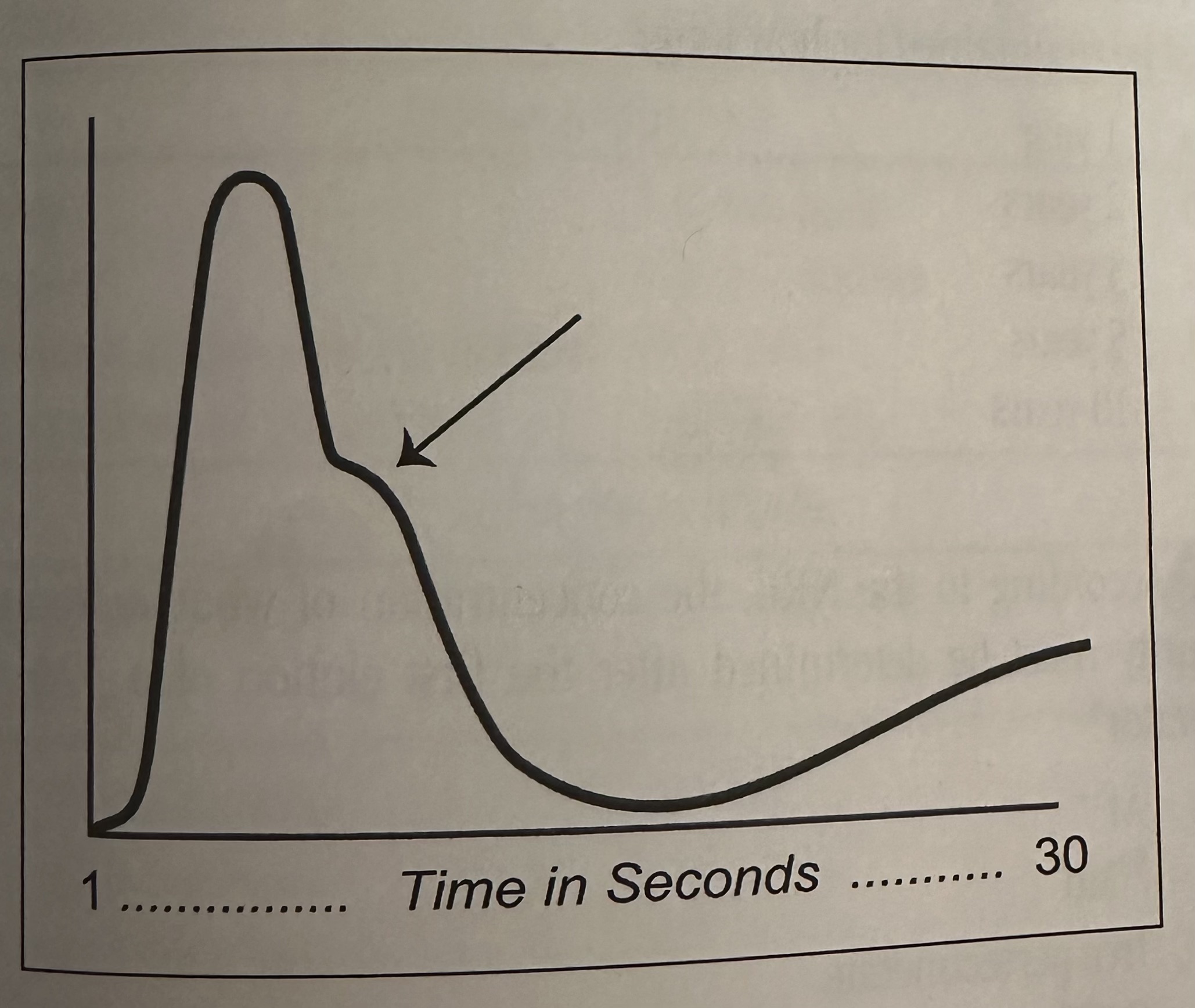 <p>Data derived from a first-pass cardiac examination and a region of interest drawn over the lung are used to generate the pulmonary time-activity curve shown here. The arrow indicates:</p><p>a. first pass of activity through the lungs<br>b. second pass of activity through the lungs<br>c. third pass of activity through the lungs<br>d. activity returning prematurely to the lungs<br>e. activity returning from the systemic circulation</p>
