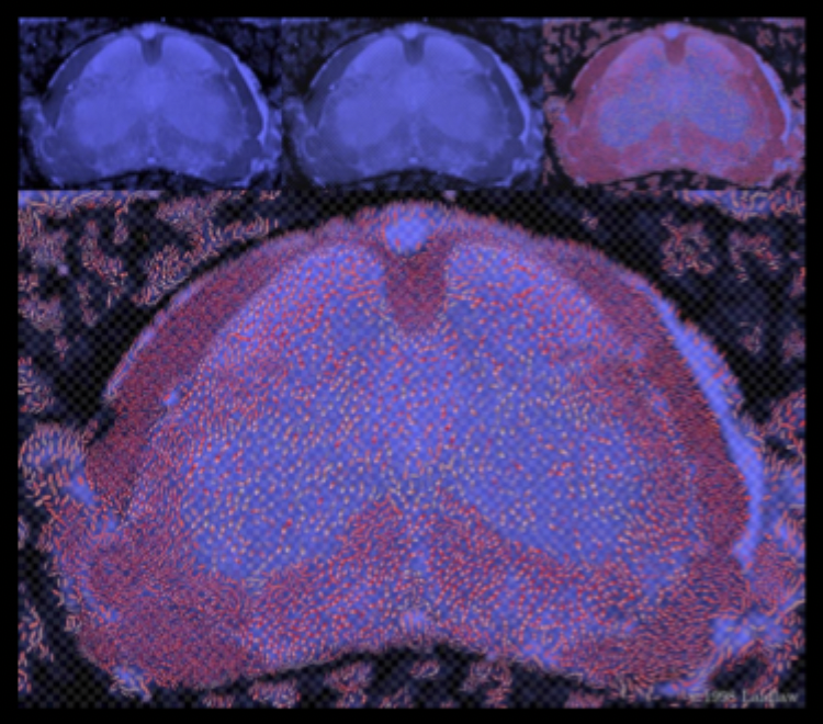 <p>David Kremers (with scientists: David Laidlaw, Eric T. Ahrens, and Matthew J. 
Avalos), Mouse Spinal Cord Diffusion Tensor Visualization Using Concepts from 
Painting, 1998.</p>