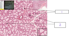 <p>What is the structure at 1</p>