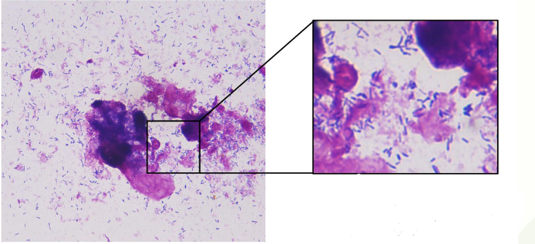 <p>______ on abdominal fluid cytology (species unknown). Note the ‘club-shaped’ rods. </p>