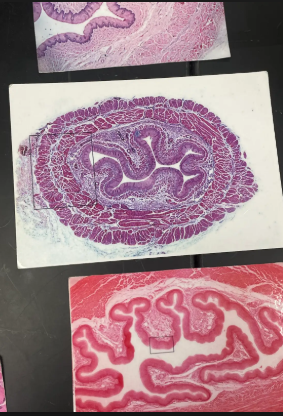 <p>Mucosa: Stratified squamous epithelium</p><p>Submucosa</p><p>Muscularis: 2 layers</p><ul><li><p>Skeletal muscle - superior 1/3</p></li><li><p>Smooth muscle - inferior 1/3</p></li></ul><p>Adventitia (not serosa)</p>