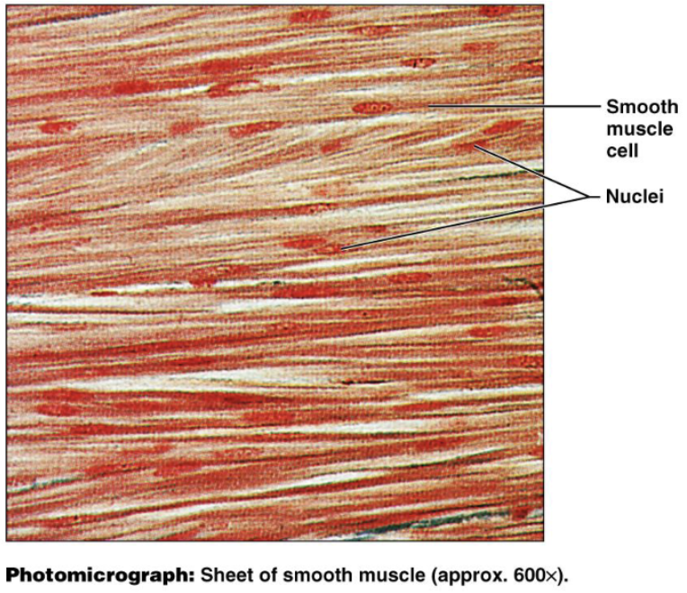 <p>Sheets of spindle-shaped cells with central nuclei that have no striations</p>