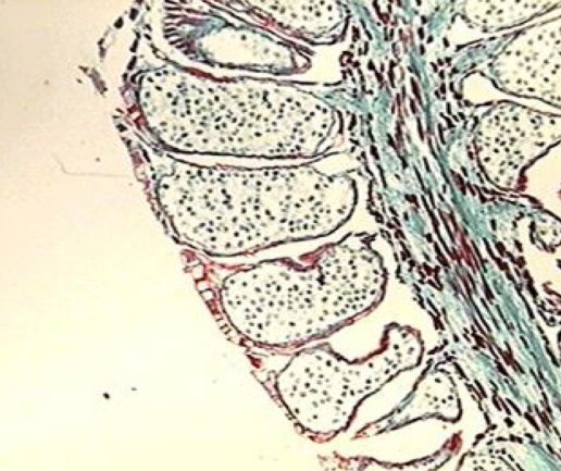 <p>Male</p>