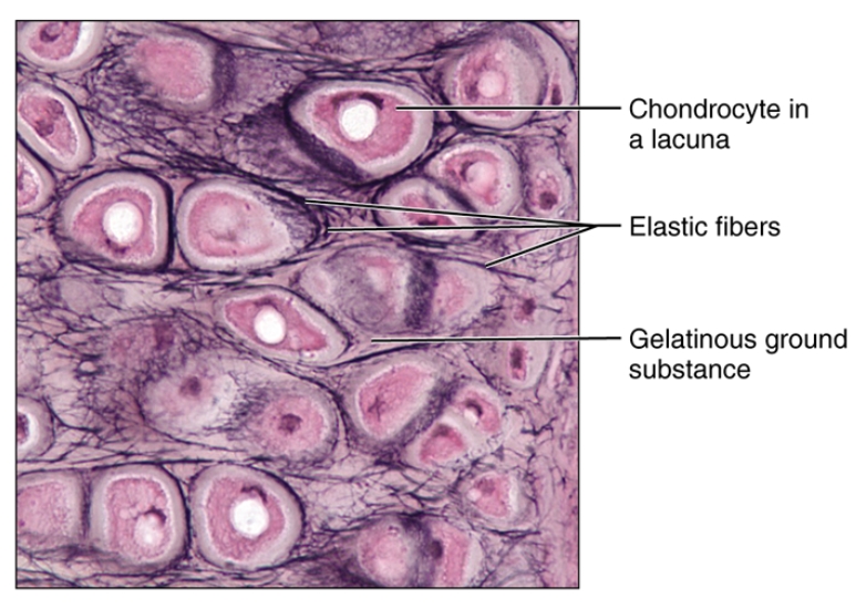 <p>Elastic cartilage</p>