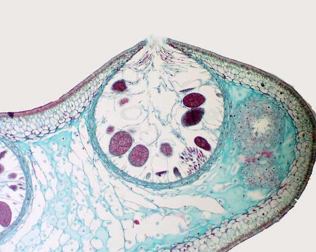 <p>Label an oogonium and antheridium of a Fucus conceptacle.</p>