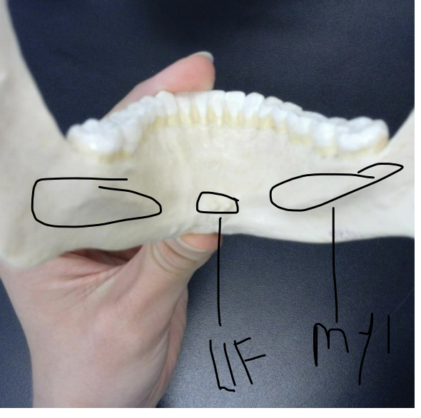 <p>lingual foramen of the mandible</p>