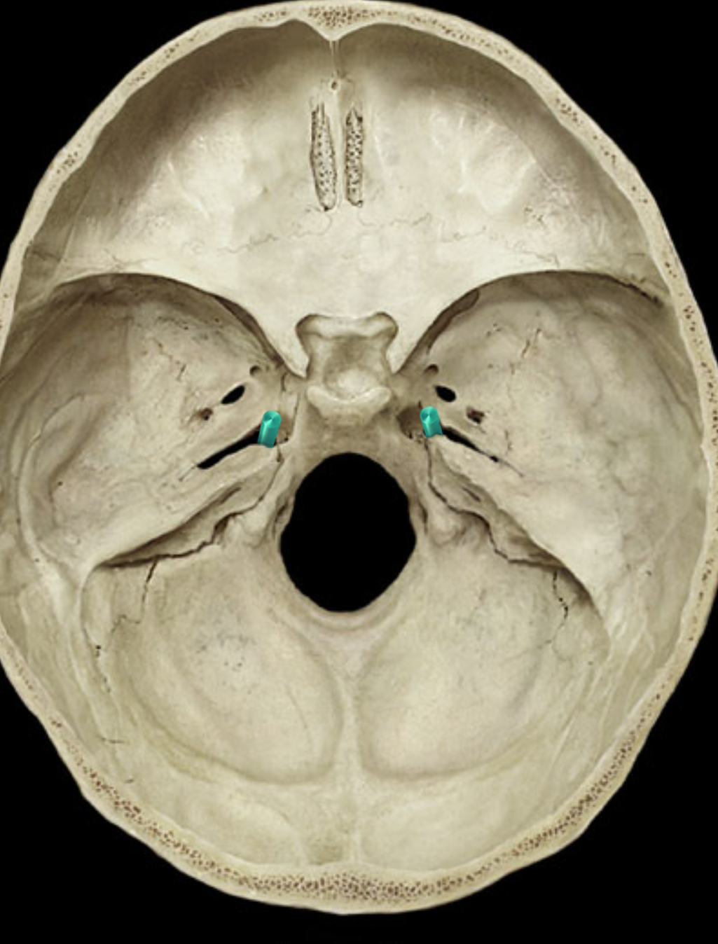 term image