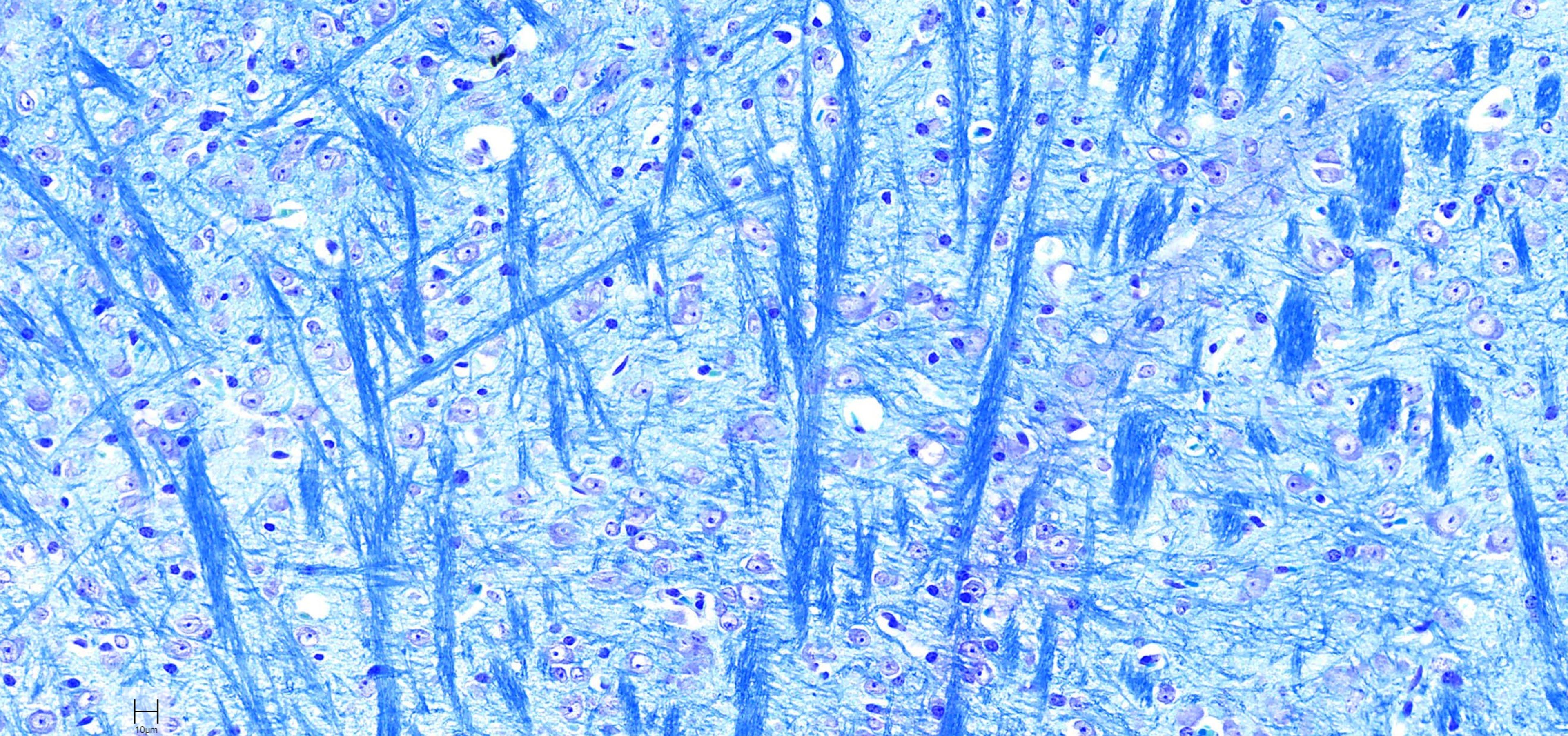 <p><em>iHisto. (n.d.). Luxol Fast Blue-stained central nervous system tissue [Photomicrograph].</em></p>