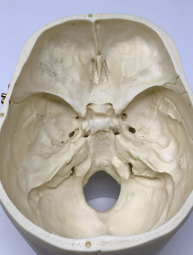 <p><span style="font-family: "Wingdings 3";">u</span><span style="font-family: "Trebuchet MS";">The base of the skull is rough, with many bony protuberances</span></p><p><span style="font-family: "Wingdings 3";">u</span><span style="font-family: "Trebuchet MS";">These ridges can result in injury to the </span><span><strong>temporal</strong></span><span style="font-family: "Trebuchet MS";"> and </span><span><strong>frontal</strong></span><span style="font-family: "Trebuchet MS";"> lobes of the brain during rapid deceleration</span></p><p><span style="font-family: "Wingdings 3";">u</span><span style="font-family: "Trebuchet MS";">definition: when the head slows or stops suddenly and the brain continues to move</span></p><p></p>