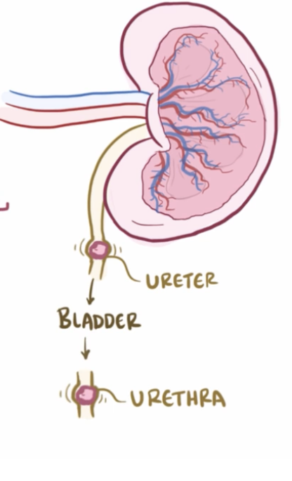 <p>Postrenal AKI</p>