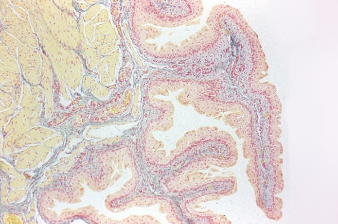 <p>Los epitelios desempeñan funciones especiales según su morfología y organización celular. El epitelio mostrado es capaz de adaptarse a cambios en volumen y tensión sin comprometer su integridad estructural, cual es la característica principal de este epitelio y en qué órgano se encuentra predominantemente:</p>